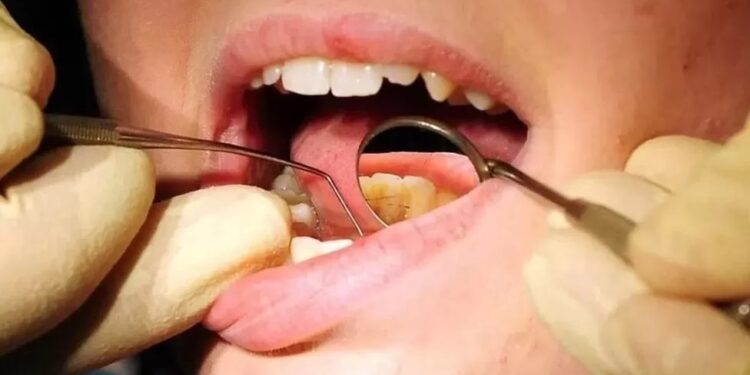 Calls for improvement over Isle of Man child oral health care