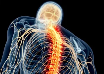 Spinal cord stimulation technology instantly improves arm and hand mobility in stroke patients