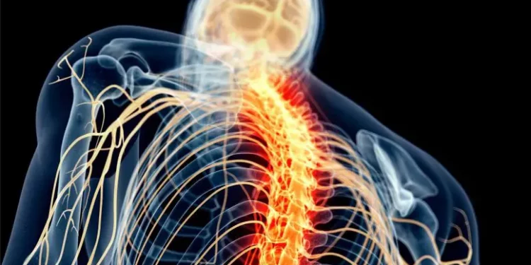 Spinal cord stimulation technology instantly improves arm and hand mobility in stroke patients
