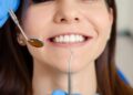 Teeth Scaling at Home: Is it Safe?