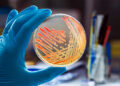 Control incidence of infection with patient blood management