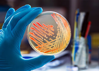 Control incidence of infection with patient blood management