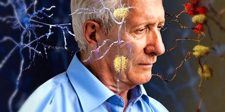 New drug to slow down Alzheimer’s disease