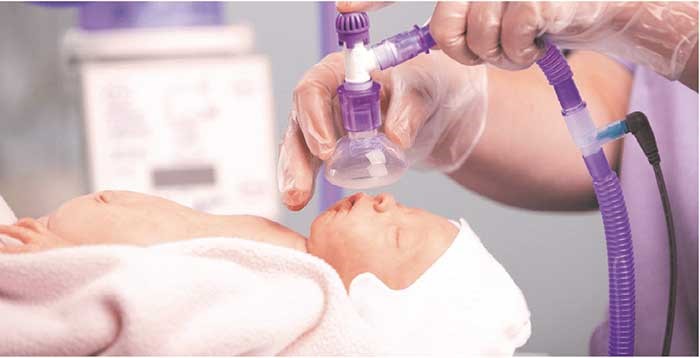 NeoFlow Resuscitation Mask and T-Piece Resuscitation Circuit