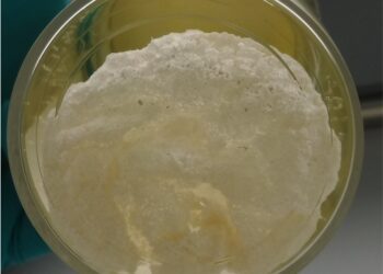 Novadip releases five-year follow-up results for NVD003, regenerative treatment for severe bone non-union of lower limb