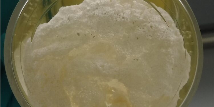 Novadip releases five-year follow-up results for NVD003, regenerative treatment for severe bone non-union of lower limb