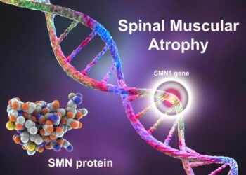 Rare diseases – spinal muscular atrophy