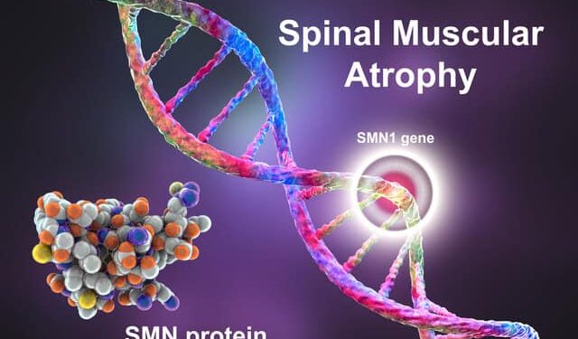 Rare diseases – spinal muscular atrophy